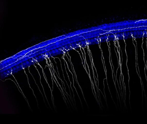 Image of the sensory epithelium of the cochlea